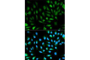 Immunofluorescence analysis of HeLa cells using PARK7 antibody (ABIN5970375). (PARK7/DJ1 抗体)