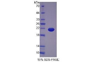 SDS-PAGE analysis of Human OPA3 Protein.