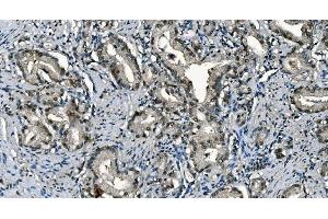 IHC analysis of CDC45L using anti-CDC45L antibody (ABIN7600230).