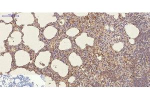Immunohistochemistry of paraffin-embedded Mouse lung tissue using CD23 Monoclonal Antibody at dilution of 1:200.