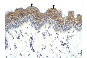 Image no. 1 for anti-LW-1 (HSFX1) (AA 224-273) antibody (ABIN6735980) (HSFX1 抗体  (AA 224-273))