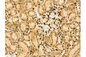 ABIN6257371 and ABIN6274204 at 1/100 staining Rat kidney tissue by IHC-P.