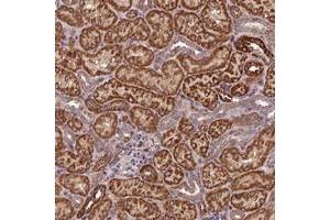 Immunohistochemical staining of human kidney with C15orf23 polyclonal antibody  shows strong cytoplasmic positivity in tubular cells at 1:50-1:200 dilution.
