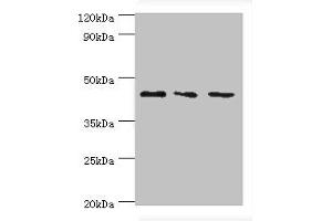 Western blot All lanes: CHI3L2 antibody at 4 μg/mL Lane 1: Hela whole cell lysate Lane 2: Rat brain tissue Lane 3: A431 whole cell lysate Secondary Goat polyclonal to rabbit IgG at 1/10000 dilution Predicted band size: 44, 35, 43 kDa Observed band size: 44 kDa (CHI3L2 抗体  (AA 27-390))