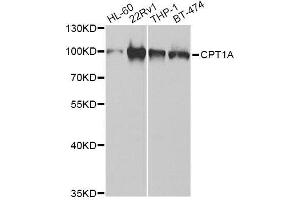 Western blot analysis of extracts of various cell lines, using CPT1A Antibody.