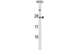 Western Blotting (WB) image for anti-TGFB-Induced Factor Homeobox 2-Like, Y-Linked (TGIF2LY) antibody (ABIN3000164) (TGIF2LY 抗体)