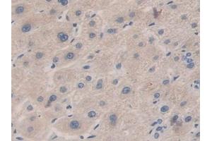 Immunohistochemistry (IHC) image for anti-Carboxypeptidase B1 (Tissue) (CPB1) (AA 111-417) antibody (ABIN7441961)