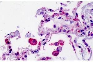 Human Lung: Formalin-Fixed, Paraffin-Embedded (FFPE) (SMO 抗体  (AA 68-117))