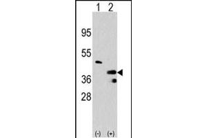 Western blot analysis of PRMT1 (arrow) using rabbit polyclonal PRMT1 Antibody (C-term) (R). (PRMT1 抗体  (C-Term))