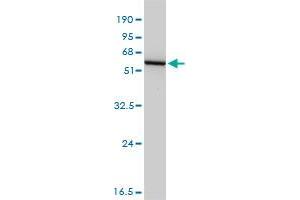 GSS monoclonal antibody (M03), clone 4B6-2C7. (Glutathione Synthetase 抗体)
