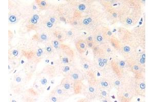 DAB staining on IHC-P; Samples: Human Liver Tissue (COL18 抗体  (AA 1572-1754))