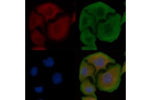 ABIN6258096 and ABIN6274395 staining Hela cells by IF/ICC. (RBM26 抗体  (Internal Region))