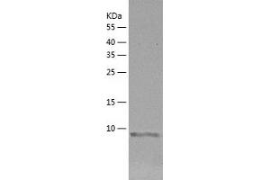 Western Blotting (WB) image for Caspase Recruitment Domain Family, Member 17 (CARD17) (AA 1-110) protein (His tag) (ABIN7287540) (CARD17 Protein (AA 1-110) (His tag))