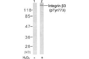 Image no. 2 for anti-Integrin beta 3 (ITGB3) (pTyr773) antibody (ABIN196720) (Integrin beta 3 抗体  (pTyr773))