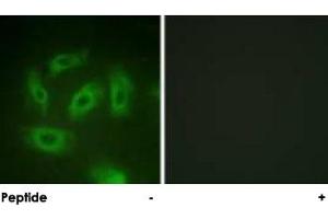Immunofluorescence analysis of HeLa cells, using TGFBR1 polyclonal antibody . (TGFBR1 抗体  (Ser165))