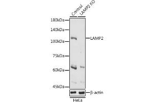 Western blot analysis of extracts of HeLa cells, using L antibody (ABIN6129969, ABIN6143081, ABIN6143082 and ABIN6218224) at 1:1000 dilution.
