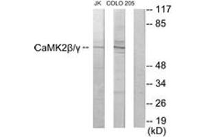 Western blot analysis of extracts from COLO205/Jurkat cells, using CaMK2 beta/gamma Antibody. (CaMK2 beta/gamma 抗体  (AA 509-558))