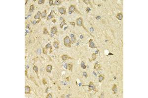 Immunohistochemistry of paraffin-embedded rat brain using IL10RA antibody at dilution of 1:200 (400x lens). (IL-10RA 抗体)