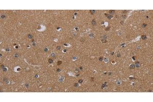 Immunohistochemistry of paraffin-embedded Human brain tissue using PDGFC Polyclonal Antibody at dilution 1:40 (PDGFC 抗体)