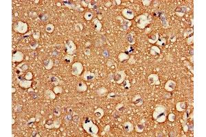 Immunohistochemistry of paraffin-embedded human brain tissue using ABIN7175266 at dilution of 1:100 (ATP6V1G2 抗体  (AA 1-118))