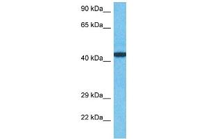 Host:  Rabbit  Target Name:  ZN410  Sample Type:  MCF7 Whole Cell lysates  Antibody Dilution:  1. (ZN410 抗体  (C-Term))