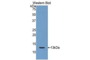 Western Blotting (WB) image for anti-Follicle Stimulating Hormone Receptor (FSHR) (AA 18-113) antibody (ABIN1175881) (FSHR 抗体  (AA 18-113))