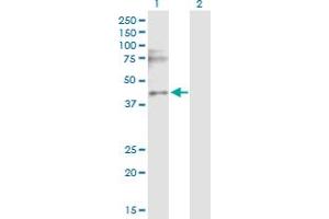 Western Blot analysis of CACNG3 expression in transfected 293T cell line by CACNG3 MaxPab polyclonal antibody. (CACNG3 抗体  (AA 1-315))