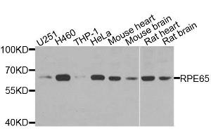Western blot analysis of extracts of various cell lines, using RPE65 antibody. (RPE65 抗体  (AA 274-533))
