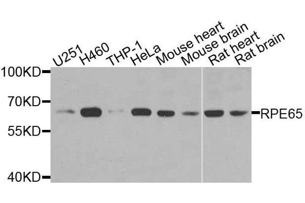 RPE65 anticorps  (AA 274-533)