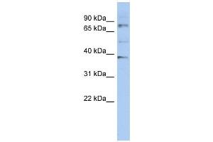 OAS2 antibody used at 1 ug/ml to detect target protein. (OAS2 抗体  (N-Term))