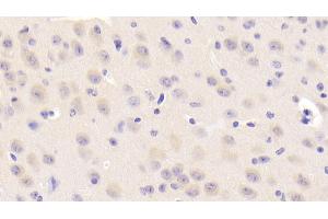 Detection of NEIL3 in Mouse Cerebrum Tissue using Polyclonal Antibody to Nei Endonuclease VIII Like Protein 3 (NEIL3) (NEIL3 抗体  (AA 2-187))