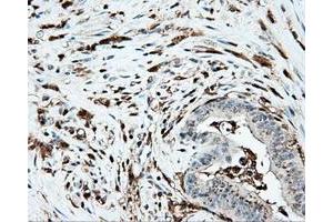 Immunohistochemical staining of paraffin-embedded Kidney tissue using anti-PLEK mouse monoclonal antibody. (Pleckstrin 抗体)