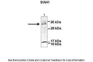 Researcher: Peter Brand & Dr. (SIAH1 抗体  (N-Term))