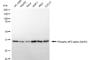 Western blotting analysis using phospho-eIF2 alpha (Ser51) antibody (ABIN7798512). (Recombinant EIF2A 抗体  (pSer51))