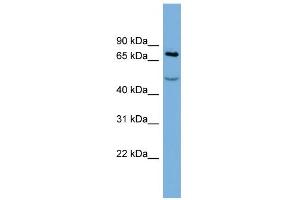 WB Suggested Anti-STIM1 Antibody Titration:  0. (STIM1 抗体  (Middle Region))