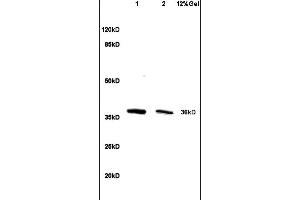 Lane 1: mouse liver lysates Lane 2: mouse intestine lysates probed with Anti HSD17B1/HSD17 Polyclonal Antibody, Unconjugated (ABIN718706) at 1:200 in 4 °C. (HSD17B1 抗体  (AA 21-120))