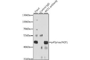 Immunoprecipitation analysis of 200 μg extracts of Raji cells, using 3 μg p47phox/NCF1 antibody (ABIN3021550, ABIN3021551, ABIN3021552 and ABIN6215231). (NCF1 抗体  (AA 1-390))