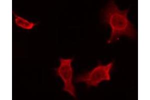 ABIN6274471 staining NIH-3T3 by IF/ICC. (MOBKL2A,B 抗体)