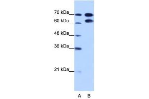 RAVER1 antibody used at 1. (RAVER1 抗体  (N-Term))