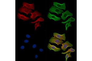 ABIN6261419 and ABIN6278340 staining Hela cells by IF/ICC. (EBI3 抗体  (N-Term))