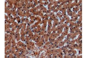 Detection of GLa in Human Liver Tissue using Monoclonal Antibody to Galactosidase Alpha (GLa)