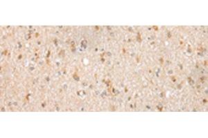 Immunohistochemistry of paraffin-embedded Human brain tissue using FKBP7 Polyclonal Antibody at dilution of 1:40(x200) (FKBP7 抗体)