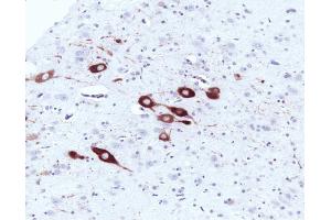 Immunohistochemical staining of a formalin-fixed paraffin-embedded rat brain tissue section with no pre-treatment (20X magnification). (NOS1 抗体  (AA 1095-1289))