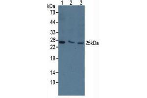 Rabbit Detection antibody from the kit in WB with Positive Control: Sample Human 293T cells. (TK1 ELISA 试剂盒)