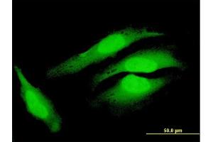 Immunofluorescence of purified MaxPab antibody to COPS8 on HeLa cell. (COPS8 抗体  (AA 1-209))