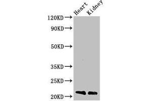 Western Blot Positive WB detected in: Mouse heart tissue, Mouse kidney tissue All lanes: SDC4 antibody at 3 μg/mL Secondary Goat polyclonal to rabbit IgG at 1/50000 dilution Predicted band size: 22, 17 kDa Observed band size: 22 kDa (SDC4 抗体  (AA 19-145))