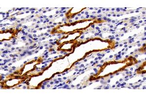 Immunohistochemistry (IHC) image for anti-Galectin 3 (LGALS3) (AA 1-262) antibody (ABIN7431566)
