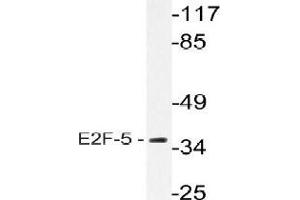 Western blot analysis of E2F5 Antibody in extracts from HeLa cells. (E2F5 抗体)