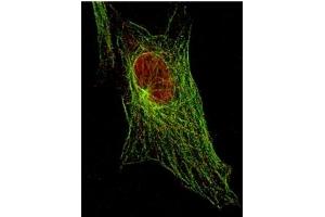 Immunofluorescence (IF) image for anti-Signal Transducer and Activator of Transcription 5A (STAT5A) (Tyr694) antibody (ABIN400812) (STAT5A 抗体  (Tyr694))