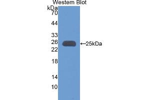 Western blot analysis of the recombinant protein. (Apolipoprotein M 抗体  (AA 20-190))